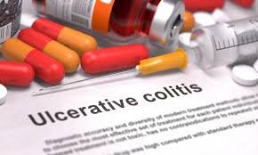 Medications for People with Ulcerative Colitis
